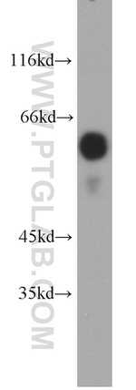 OCT2 Antibody in Western Blot (WB)