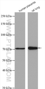 GUCY1B3 Antibody in Western Blot (WB)