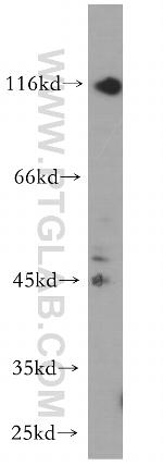 P2RX5 Antibody in Western Blot (WB)