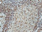 NOX2 Antibody in Immunohistochemistry (Paraffin) (IHC (P))