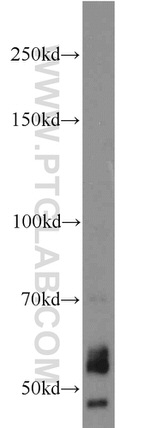 NOX2 Antibody in Western Blot (WB)