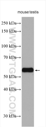 ARSA Antibody in Western Blot (WB)