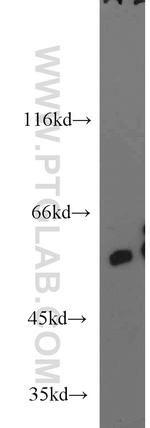 ARSA Antibody in Western Blot (WB)