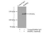 BMPR2 Antibody in Immunoprecipitation (IP)