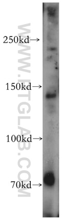 ALPK1 Antibody in Western Blot (WB)