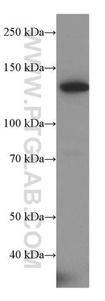 ALPK1 Antibody in Western Blot (WB)