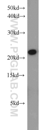 PSMB5 Antibody in Western Blot (WB)