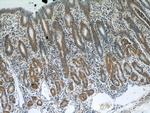 NUP85 Antibody in Immunohistochemistry (Paraffin) (IHC (P))