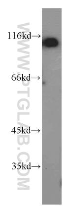 USP10 Antibody in Western Blot (WB)