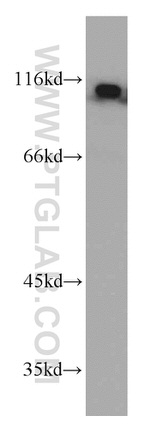 USP10 Antibody in Western Blot (WB)