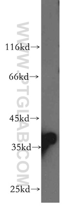 PIH1D1 Antibody in Western Blot (WB)