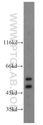 ZIP7 Antibody in Western Blot (WB)