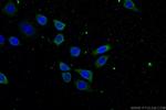 ATP9A Antibody in Immunocytochemistry (ICC/IF)