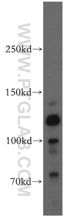 PACS2 Antibody in Western Blot (WB)