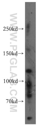 PACS2 Antibody in Western Blot (WB)