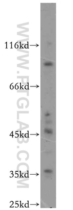 MOGAT2 Antibody in Western Blot (WB)
