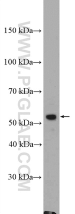 ZIP kinase Antibody in Western Blot (WB)