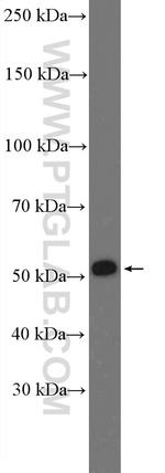 ZIP kinase Antibody in Western Blot (WB)