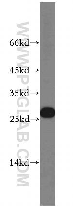 MXD1 Antibody in Western Blot (WB)