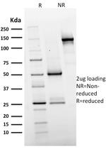 EGFR (Epidermal Growth Factor Receptor) Antibody in SDS-PAGE (SDS-PAGE)