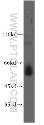 NAB2 Antibody in Western Blot (WB)