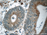 MUTYH Antibody in Immunohistochemistry (Paraffin) (IHC (P))