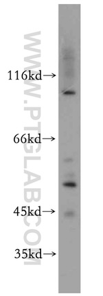 MUTYH Antibody in Western Blot (WB)