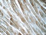 BAI2 Antibody in Immunohistochemistry (Paraffin) (IHC (P))