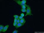 LIMK1 Antibody in Immunocytochemistry (ICC/IF)