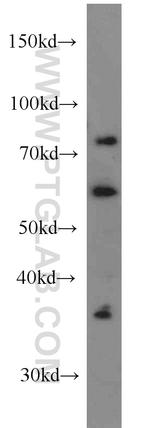 LIMK1 Antibody in Western Blot (WB)