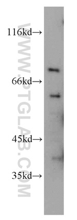 LIMK1 Antibody in Western Blot (WB)