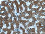 Thrombospondin 3 Antibody in Immunohistochemistry (Paraffin) (IHC (P))