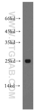 Urocortin Antibody in Western Blot (WB)