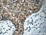 APC Antibody in Immunohistochemistry (Paraffin) (IHC (P))