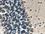 ATP7B Antibody in Immunohistochemistry (Paraffin) (IHC (P))