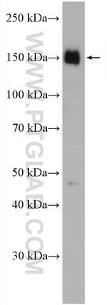 ATP7B Antibody in Western Blot (WB)