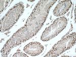 ATR Antibody in Immunohistochemistry (Paraffin) (IHC (P))