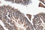 ATR Antibody in Immunohistochemistry (Paraffin) (IHC (P))