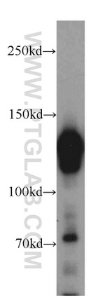 STAG2 Antibody in Western Blot (WB)