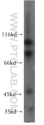 CALCOCO1 Antibody in Western Blot (WB)