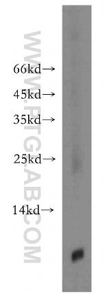 TMSB4X Antibody in Western Blot (WB)