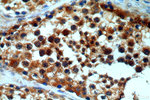 ASUN Antibody in Immunohistochemistry (Paraffin) (IHC (P))