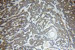 ASUN Antibody in Immunohistochemistry (Paraffin) (IHC (P))