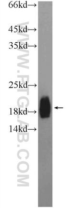 ZNF747 Antibody in Western Blot (WB)