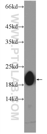 ZNF747 Antibody in Western Blot (WB)