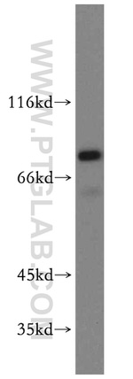 CEP72 Antibody in Western Blot (WB)