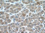 CYP2E1 Antibody in Immunohistochemistry (Paraffin) (IHC (P))