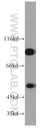 GAC Antibody in Western Blot (WB)