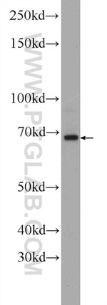 GAC Antibody in Western Blot (WB)