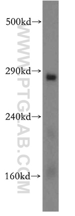 ITPR1 Antibody in Western Blot (WB)